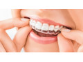 دندان مصنوعی ارزان - نخ دندان