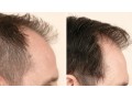 رفع کم پشتی مو با پودرپرپشت کننده تاپیک