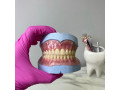 ساخت انواع دندان مصنوعی