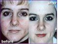 رفع کننده کلیه چین و چروک صورت-پوست،رفع کننده لک های پوستی و سفید کننده پوست - سفید پارس