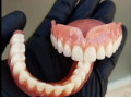 دندانسازی عرب مدائنی - دندانسازی ارزان