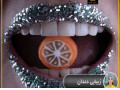 لمینیت دندان در شرق تهران