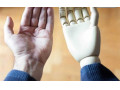 ساخت اندام مصنوعی از جمله : پروتز دست مصنوعی و پا  - جمله برای روز حسابدار