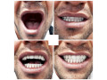 دندانسازی‌پارسیل((متخصص درساخت انواع دندان مصنوعی و روکش))