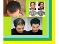  پرپشت کننده مو/تاپیک المان - پرپشت شدن موی سر