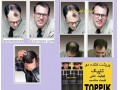 Icon for فروش بهترین پودر مو سوپر تاپیک