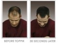 پرپشت کننده مو در 30 ثانیه 100% طبیعی  - پرپشت کننده قوی موی سر
