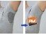 پد ضد عرق Underarm Shields