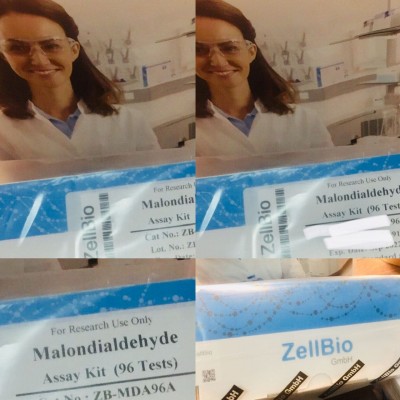  کیت الایزا  malondialdehyde   96 T