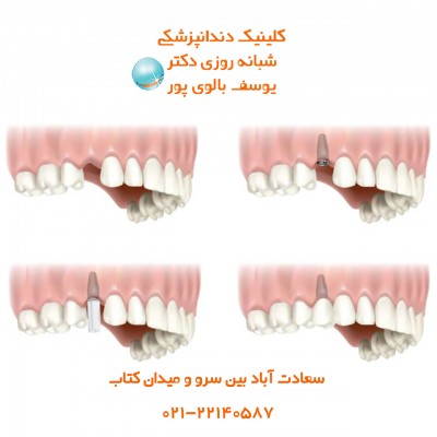 دندانپزشکی بالوی پور، ارائه دهنده کلیه خدمات دندان پزشکی با قیمت مناسب