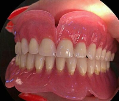 دندان متحرک