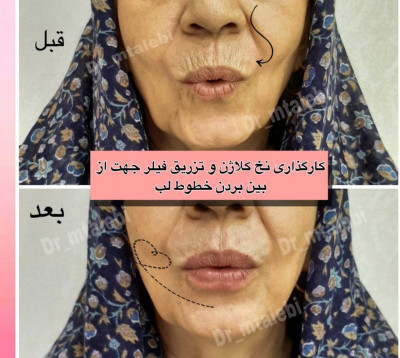 مرکزپوست ومووزیبایی دکترمهشیدطالبی