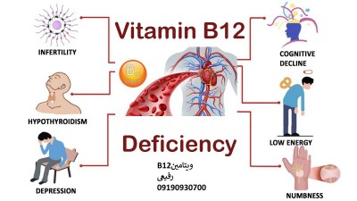 قیمت ویتامین B12- فروش عمده ویتامین B12