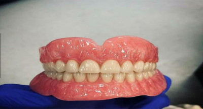 ساخت انواع دندان مصنوعی 