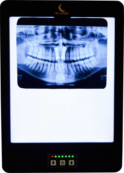 نگاتوسکوپ دندان پزشکی, نگاتسکوپ دندانپزشکی,نگاتوسکوپ CBCT,