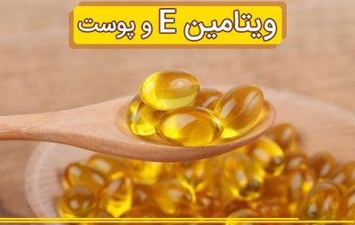 فروش ویژه ویتامین ها با تضمین کیفیت