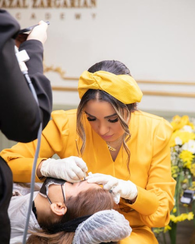 پاک کردن تاتو خط چشم در تهران