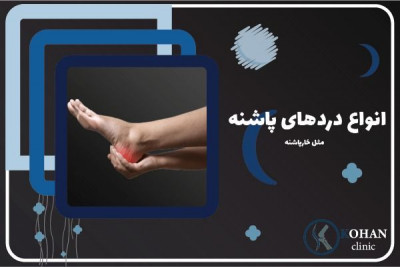 کلینیک خارپاشنه در مرزداران غرب تهران - بدون جراحی و تزریق