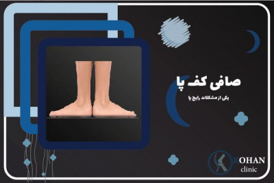 تخصصی ترین کلینیک صافی کف پا در سعادت اباد تهران