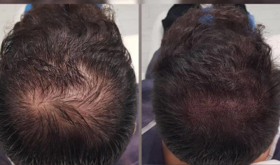 مرکز تخصصی میکرواسکالپ مژده پورسلطانی در رشت