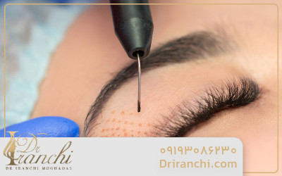 زیبایی بینی و بدن بدون جراحی با دکتر ایرانچی