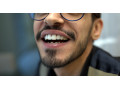 Icon for سفید کردن دندان در تهران