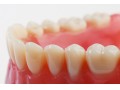 Icon for ساخت دست دندان