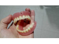 دندان رایگان
