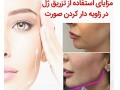 مشاوره پزشکی پوست وزیبایی درشرق وشمال تهران