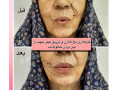 مرکزپوست ومووزیبایی دکترمهشیدطالبی