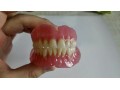 دندانسازی - دندانسازی با بیمه