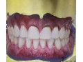 دندانسازی ارزان در تهرانسر - تهرانسر