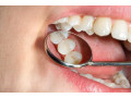 Icon for ترمیم پوسیدگی های دندانی