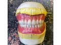 ساخت انواع دندان مصنوعی،ساخت پلاک کروم کبالت براساس فک،ساخت پروتز فلکسی و… - پروتز فرم دهنده