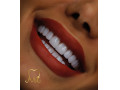 Icon for کامپوزیت دندان