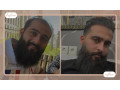 Icon for کاشت مو و ابرو با پرداخت 8 تومن و قسطی