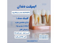 Icon for کاشت ایمپلنت بدون فشار مالی با اقساط بلند مدت