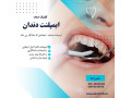 Icon for ایمپلنت ، بازسازی عملکرد طبیعی دندان ها با تکنولوژی روز