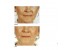 آموزش اسکین کر skin care