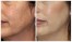 جوانساز پوست - رفع کننده لک های پوستی