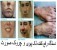 لایه بردار طبیعی پوست-ضد لک و چروک پوست و رفع کننده اسکار و جوشگاه ها و خطوط صورت و پیشانی تلفن دفتر فروش:02188936892-09196218617
