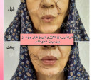 Special:  مرکزپوست ومووزیبایی دکترمهشیدطالبی